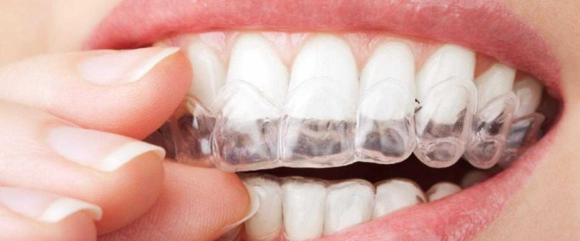 Лечение бруксизма