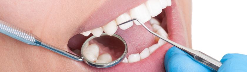 Лечение пародонтита