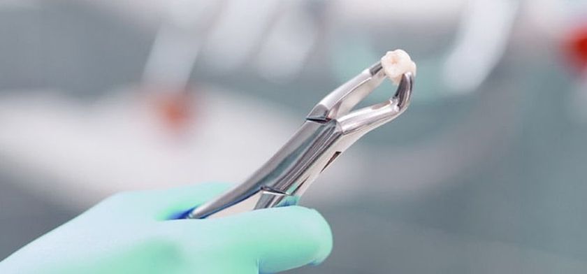 Удаление зуба мудрости